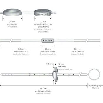 PROGAV 2.0 SYS SA2.0 15 & PRECHAMBER